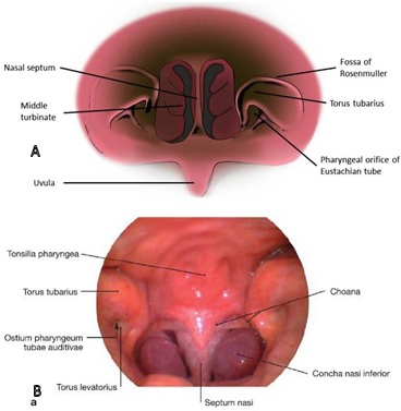 Nasopharynx&nbsp;from&nbsp;looks&nbsp;anterior. 14,15&nbsp;A.&nbsp;illustration,&nbsp;B&nbsp;.&nbsp;picture&nbsp;endoscopy
