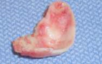 Picture 9. Cartilage Konka.2