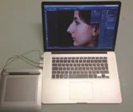 Picture 15. Photo patient pre-operation on Which analyzed in a laptop.19