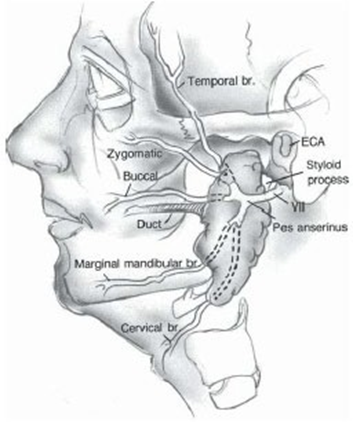 Gland&nbsp;parotid&nbsp;And&nbsp;branching&nbsp;nerve&nbsp;facialist