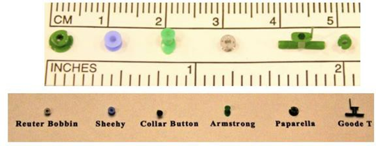 Picture 2.8. Example tube tympanostomy 26