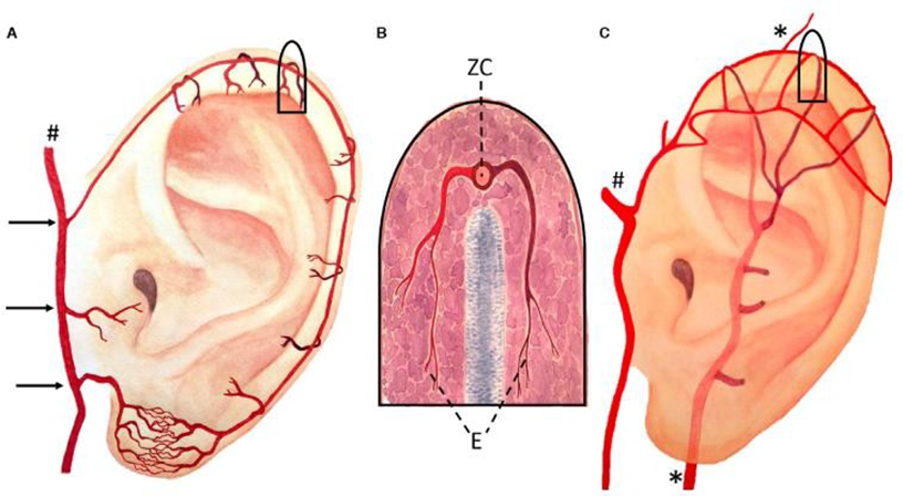 Picture 3. Supply Vascular on Pinna. 10