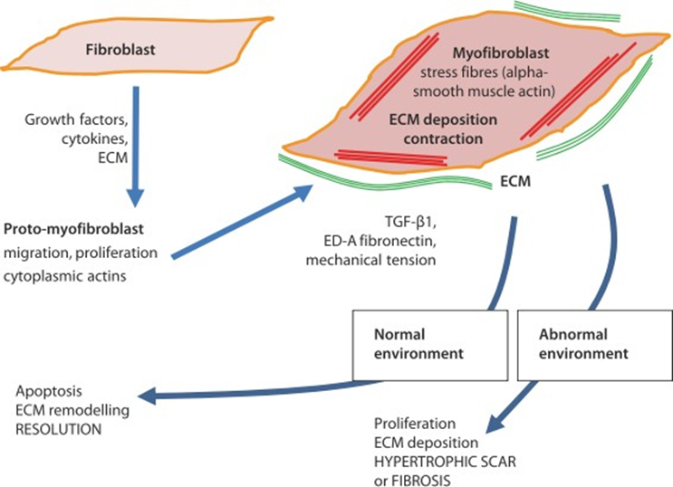 Picture 5. Scheme Illustration Process Healing Wound ( Wound Healing ) Normal and Pathological in Keloid Formation. 13