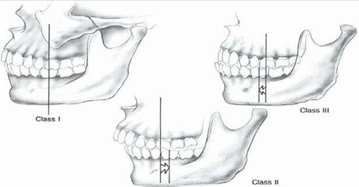 Picture 8. Relationship There is whether or not tooth on line fracture. 3