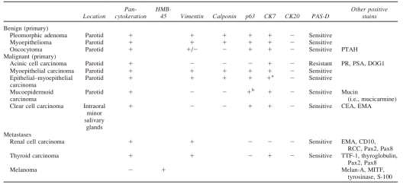 Table&nbsp;2.&nbsp;Immunohistochemistry&nbsp;And&nbsp;coloring&nbsp;special&nbsp;from&nbsp;lesi&nbsp;clear&nbsp;cell&nbsp;gland&nbsp;saliva. 6