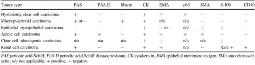 Table&nbsp;3.&nbsp;Diagnosis&nbsp;appeal&nbsp;And&nbsp;pattern&nbsp;coloring&nbsp;tumor&nbsp;clear&nbsp;cell&nbsp;head&nbsp;and neck. 18