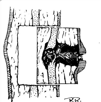 Picture 7. (a) Method Stevenson (b) Method Stroud 33