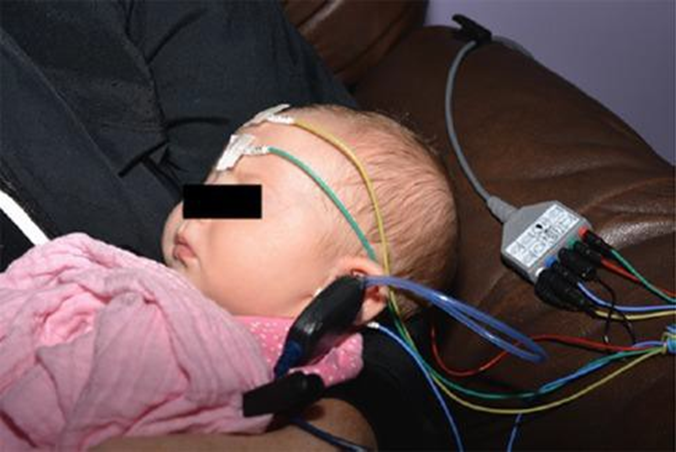 Picture 2.11 Baby undergo ABR without sedation (natural sleep). 9