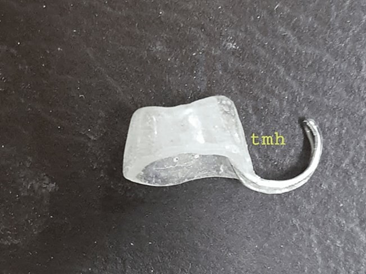 Picture 5. Use stent prosthesis acrylic 6