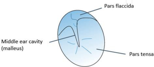 Figure 2. Membrane Structure Timpani. 4