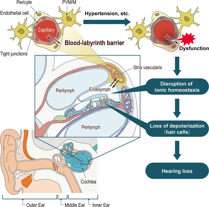Figure 8. Process disturbance hearing on cochlea