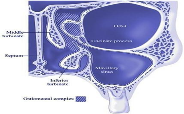 Picture 2.2 Complex Ostiomeatal